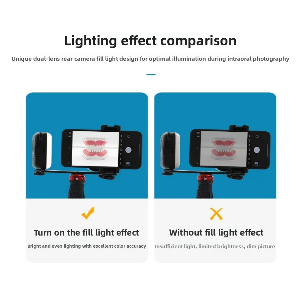 Dental Photography Light, Blue - Photography Lighting Set Up 评论和价格