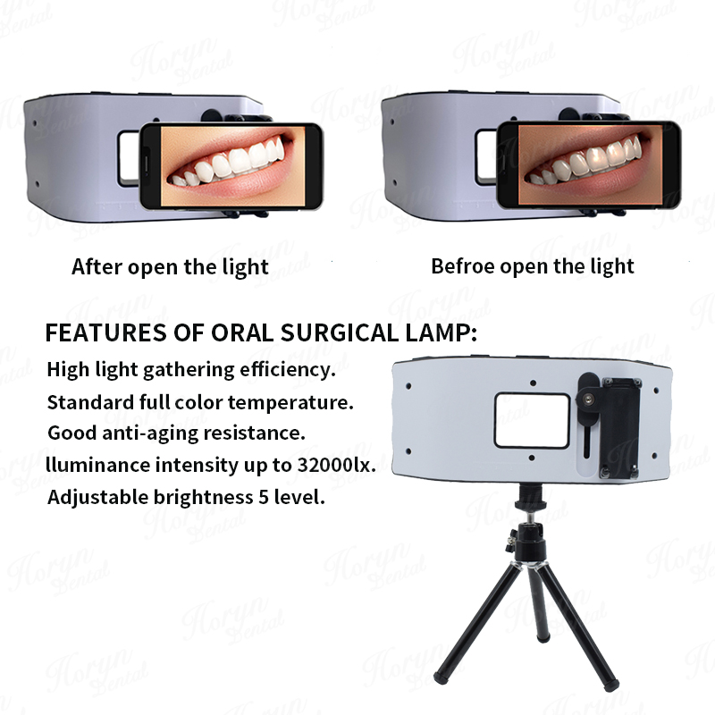 Dental Flash Light Photography - Photography Lighting Equipment 评论和价格